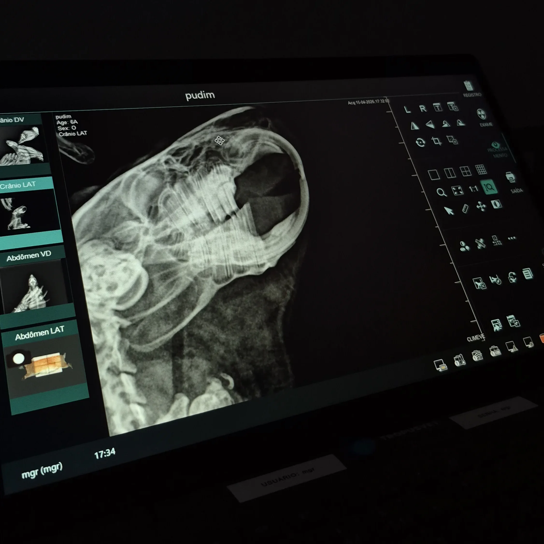 Imagem de raio-X exibida no monitor do hospital
